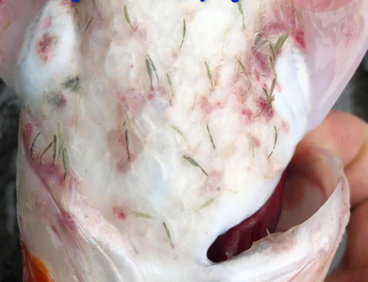 tri benh trung mo neo